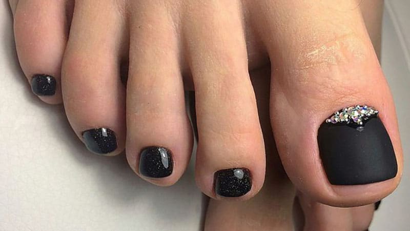 Black Toenails